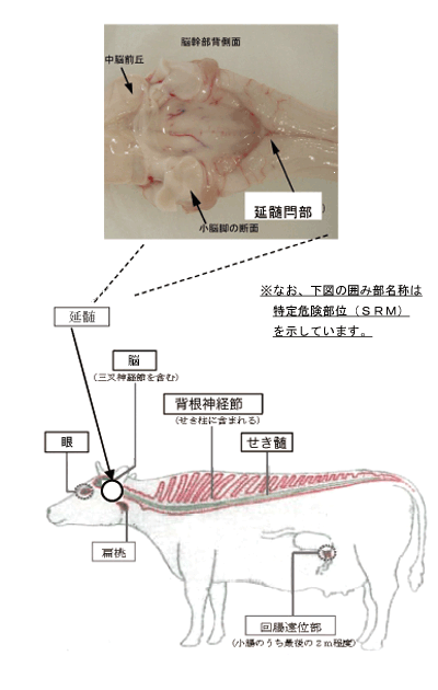 延髄閂部