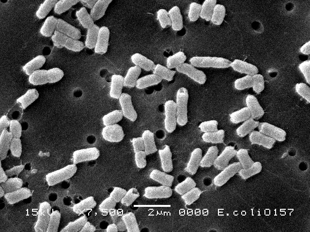 腸管出血性大腸菌-157電子顕微鏡写真