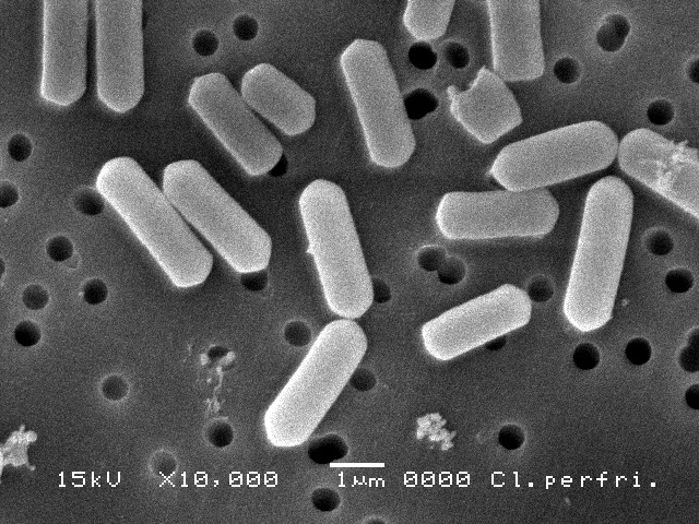 ウエルシュ菌電子顕微鏡写真