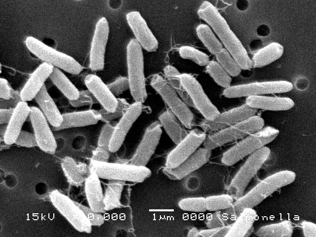 サルモネラ属菌電子顕微鏡写真