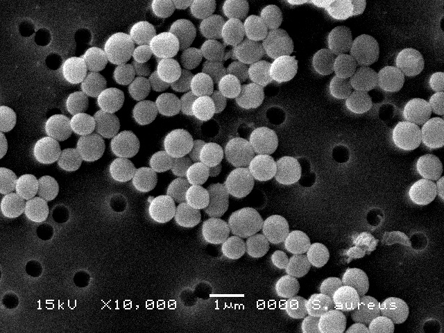 黄色ブドウ球菌電子顕微鏡写真